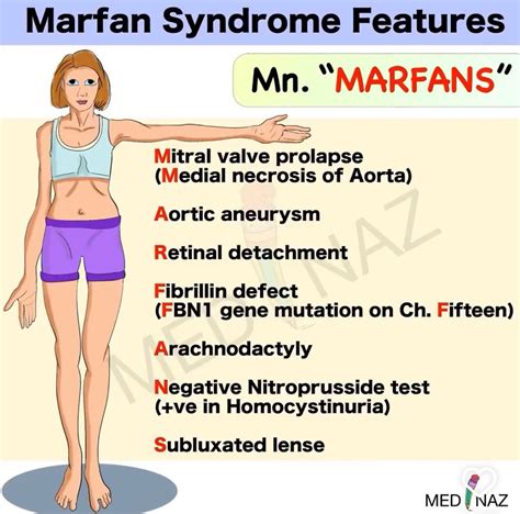 Systemic Features Of Marfan Syndrome Mnemonic The Best Porn Website