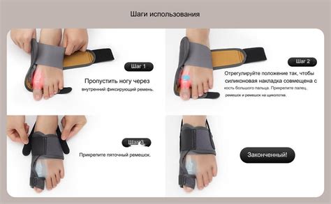 Вальгусная шарнирная шина с регулировкой угла отклонения / Бандаж ...