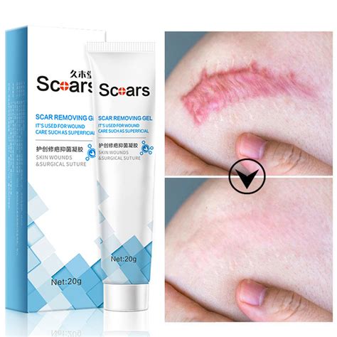 Jiumutang Scar Removal Cream Peklat Remover Acne Treatment Scar Remover