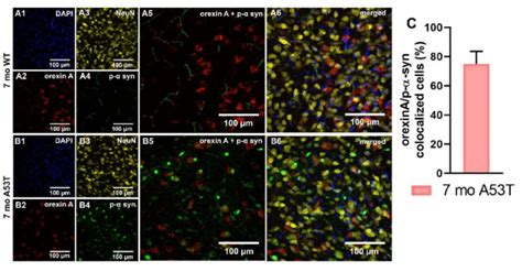 Quantification And Localization Of Orexin A Neuronal α Syn