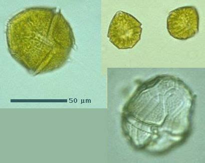 Peridinium sp. | Protists, Science nature, Zoology