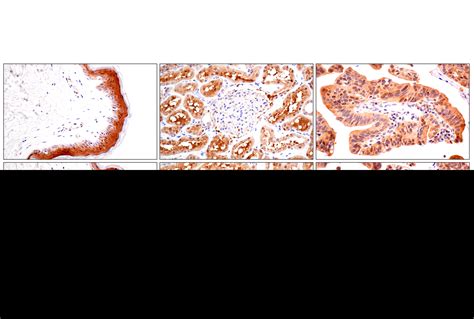 ACBP DBI E6K8G XP Rabbit MAb Cell Signaling Technology