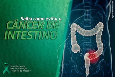 Saiba Como Evitar O Câncer De Intestino Clínica Romanholi