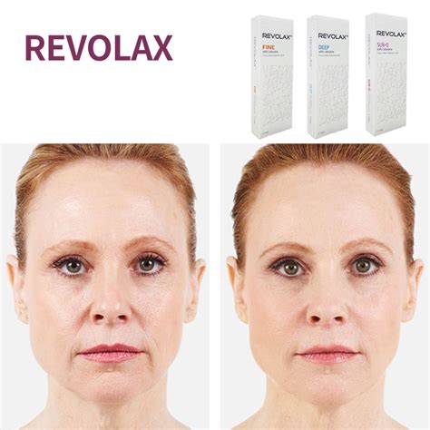 High Quality Cross Linked Hyaluronic Acid With Lidocaine Revolax Reduce