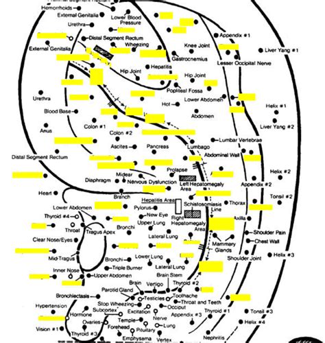 Pts Channels IV Auricular Location Diagram Quizlet