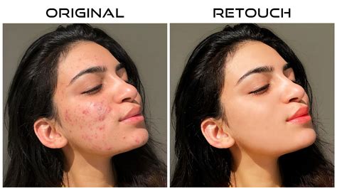 Retouching Acne Pimple Behance