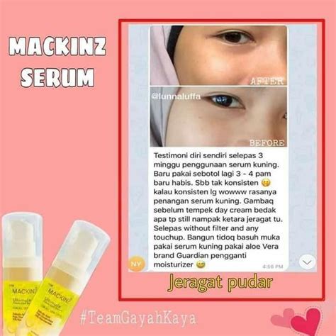 Serum Kuning Viral MACKINZ On Carousell