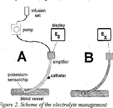 Figure 1 From Catheter System For Potassium Measurement In Medical Application Semantic Scholar