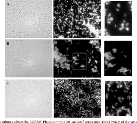 Figure 1 From Design And Performance Of A 16 S RRNA Targeted