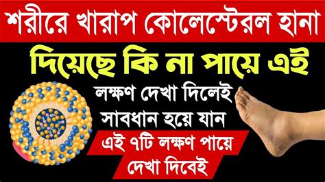 শরীরে কোলেস্টেরল বাসা বেঁধেছে কি না পায়ে এই লক্ষণ দেখা দিলেই সাবধান নয়তো ডাক্তারও কিছু করতে