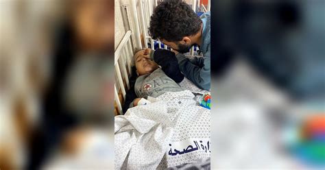 FOTO Kisah Pilu Bocah Palestina Dua Kali Kena Serangan Israel Kini