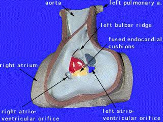 Ventricular Septum Anatomy