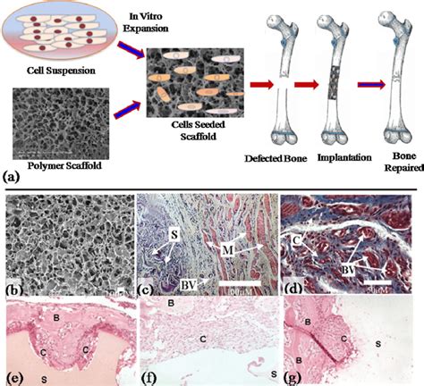 Regeneration Of Bone Tissue Using Cell Seeded Scaffold A Schematic Download Scientific