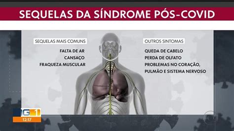 SUS ajuda a enfrentar as consequências da Covid 19 MG1 G1