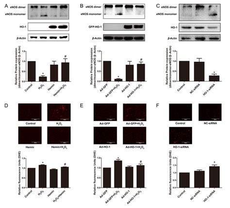 Heme Oxygenase Ameliorates Oxidative Stress Induced Endothelial