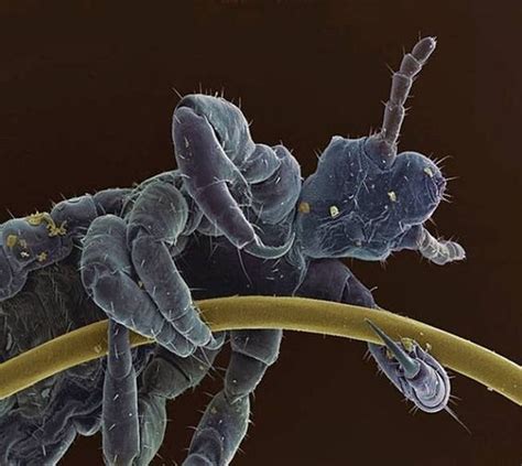 Head Lice Under Microscope