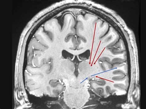 Neurociencia Colombia On Twitter Las Proyecciones De La Corteza