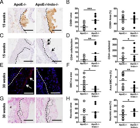 Indoleamine Dioxygenase Is Protective In Atherosclerosis And Its