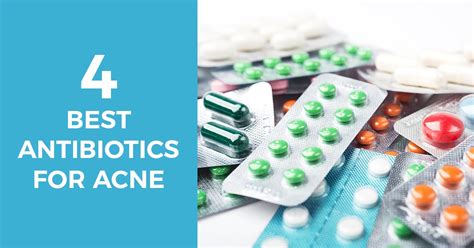 A List Of 4 Antibiotics Used To Treat Acne Successfully