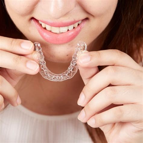 Ceramic Braces Vs Clear Aligners Which One Is Better Living Gossip