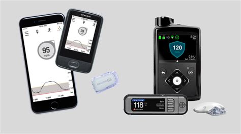 Do CGM Really Help Patients Improve Diabetes Management? – Diabetes Daily