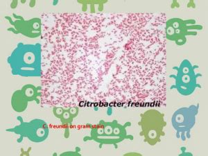 Citrobacter freundii - Characteristics, Symptoms, Treatment