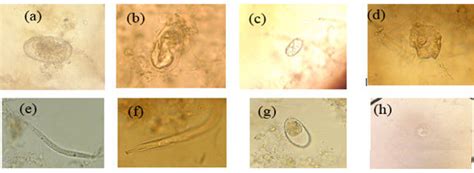 A Hookworm Eggs B Enterobius Vermicularis Eggs C Giardia Cysts Download Scientific