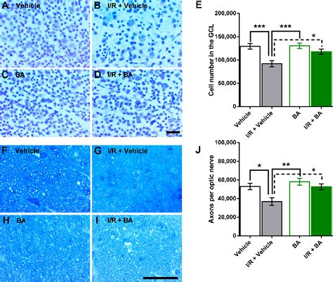 Figure 1 From Betulinic Acid Protects From Ischemia Reperfusion Injury