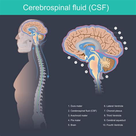 Integra LifeSciences And FDA Medical Device Recall Of CSF Systems