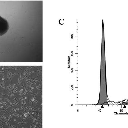 Biological Characteristics Of Human Hair Follicle Derived Mesenchymal