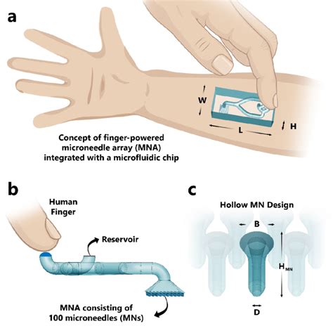 Concept Of Finger Powered Microneedle Array Mna Integrated With A