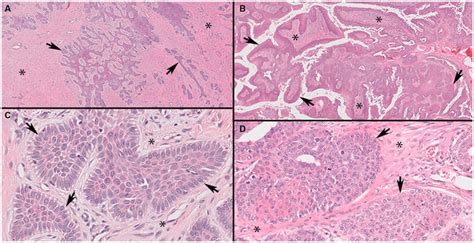 Representative Photomicrographs Of Canine Acanthomatous Ameloblastoma