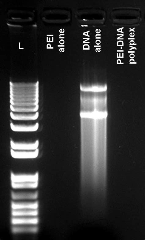 Plasmid Dna Gel