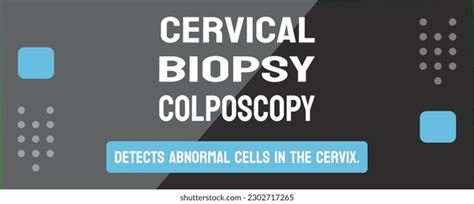 Cervical Biopsy Colposcopy Diagnostic Procedures Cervical Stock Vector (Royalty Free) 2302717265 ...