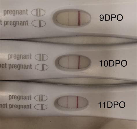 How Long After Implantation Bleeding Can You Test Bmp Vision