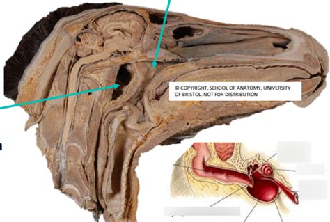 auditory tube and nasopharynx Diagram | Quizlet