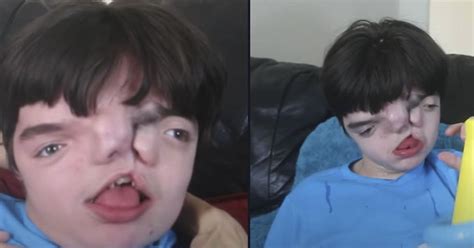 Boy Born With Two Faces Because Of Sonic The Hedgehog Gene Secret