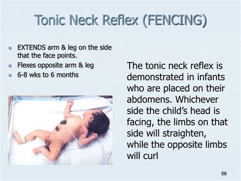 Ppt Newborn Nursing Powerpoint Presentation Id6966884