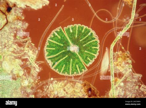 Light Micrograph Of The Desmid Micrasterias Sp Seen Among Filamentous