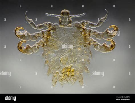 Human Crab Louse Pediculus Pubis Photomicrograph Stock Photo Alamy