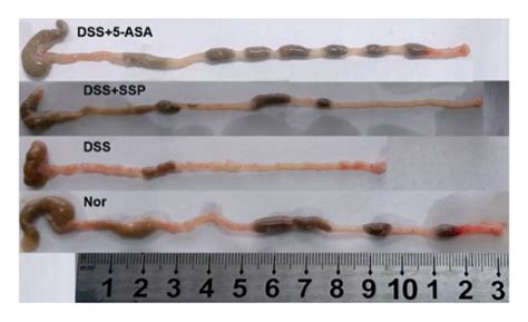 Ssp Ameliorates Dss Induced Colitis In Mice A Changes In Colon