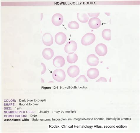 Blood Morphology Ask Hematologist Understand Hematology Artofit