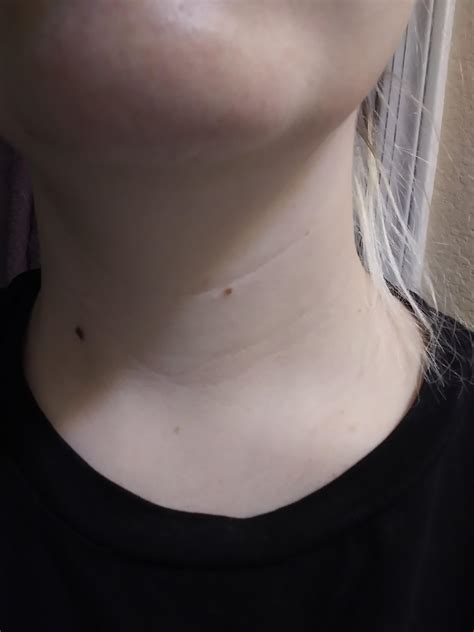 why do i have lines on my neck - Pregnancy Informations