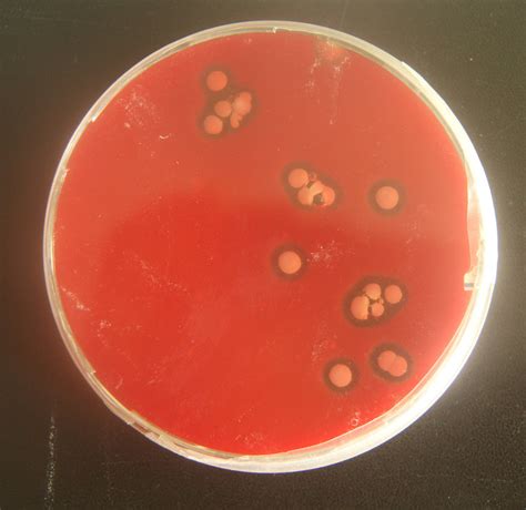 Hemolysis On Blood Agar Plate - cloudshareinfo