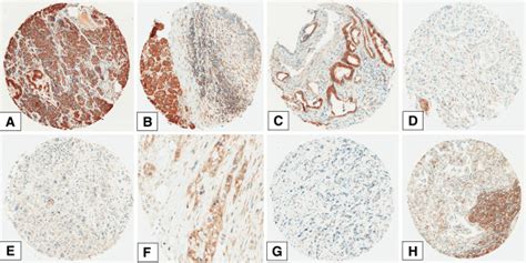 Representative Examples Of Rkip Staining A Normal Pancreatic Tissue