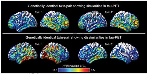 Identical Twins Share Tau Trajectory But Lifestyle Can Make A