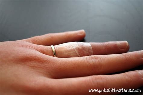 Remove A Ring From A Swollen Finger How To Remove Rings Helpful Hints