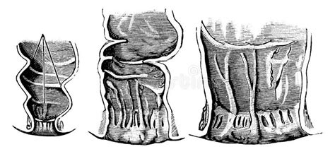 Desenvolvimento Da Ilustra O Da Colheita Da Cavidade Anal Ilustra O Do Vetor Ilustra O De