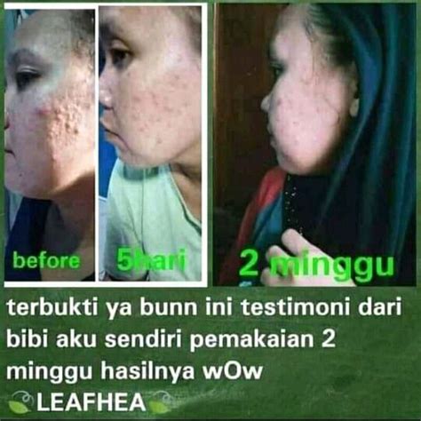 Jual Paket Skin Care Leafhea Shopee Indonesia