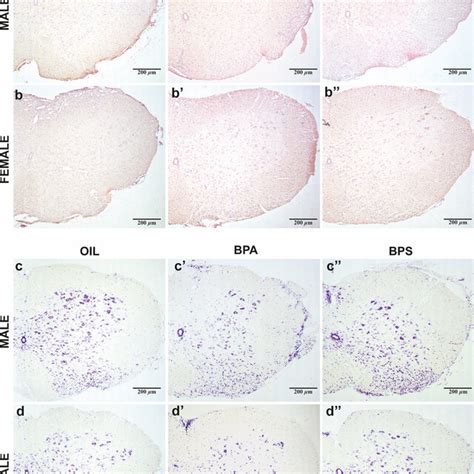 Histological Staining Of Eae Affect Mices Spinal Cord Representative